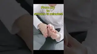 Smooth Feet in Minutes! 🔥 The Best Electronic Foot Grinder