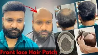 Front lace hair patch Fixing | Natural Looking Hair Patch | @LooksEnhance  | Most Thik Hair Patch 