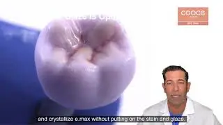 Tip of the Day: Self Glazing e.max