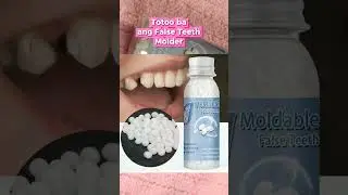 failed on my 1st attempt sa moldable false teeth