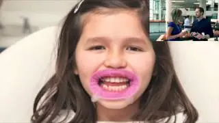 Meet The Dentist Who Uses OptraGate Lip Retractor Successfully