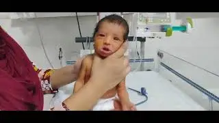 👶Newborn Baby in Pain |Glycerin Suppository Use in Constipation #babyco #babyconstipation #nicunurse