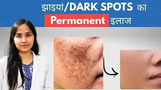 Dark Spots & Melasma ka Best Homeopathic Treatment | One Medicine for Clear Glowing Skin