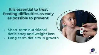 Feeding difficulties and disorders