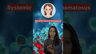Systemic lupus erythematosus (SLE) #animalphysiology #csirnet #gate #neet #cuet #csirnetlifescience