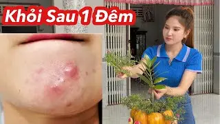 Mụn Bọc Mụn Trứng Cá Nặng Mấy Cũng Khỏi Sau 1 Đêm Sử Dụng Lá Thuốc Tự Nhiên Này