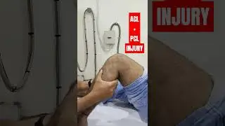 Повреждение передней крестообразной связки коленного сустава | Тест выдвижного ящика | #реконстру...