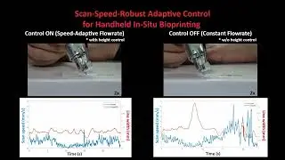 Scan-Speed-Robust Adaptive Control for Handheld In-Situ Bioprinting