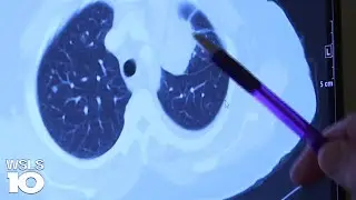Push to update black lung disease benefits