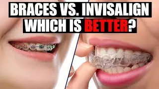 Braces Vs. Invisalign - Which Is Better? - Orthodontic Specialist Advice