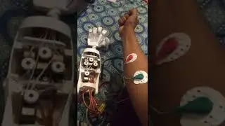 3D printed Robotic Prosthetic Arm