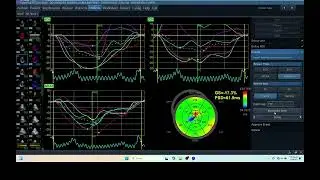 IQ 230 GWE MYOCARDIAL WORK INDEX EFFICIENCY MEASUREMENT ECHOCARDIOGRAPHY ECHOPAC ANALYSIS