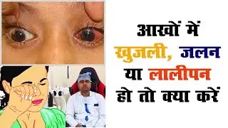 आँखों में खुजली और जलन होना || Treatment of Vernal keratoconjunctiviti || Eye Itching