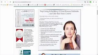 Skinception&trade; Rosacea Relief Serum - relief for dry, itchy and inflamed facial skin