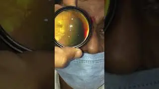 Macular star _ajay Dudani