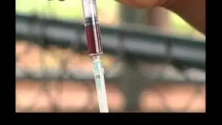 How to dose Goats and Sheep