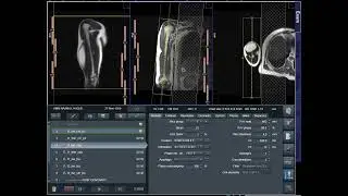 How to Do MRI of Right Arm | Full Planning Tutorial (1.5T/3T)