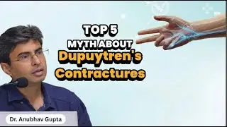 Top 5 Myths About Dupuytren&rsquo;s Contracture | Hand Surgeon Explains the Truth
