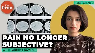Brain biomarkers of pain identified