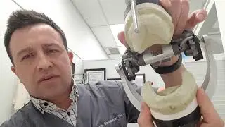 Индивидуальный план для зубного протезирования