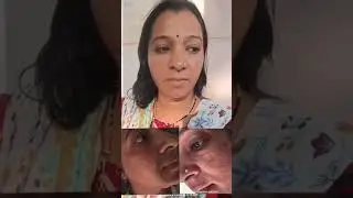 Pigmentation result after 7 days