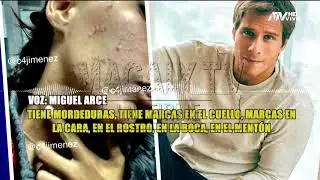 Miguel Arce revela cómo se encuentra Tephi Valenzuela tras agresión que sufrió de su pareja