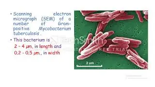Etiology of Tuberculosis ; What is the cause of Tuberculosis ? and what are the Risk Factors ?