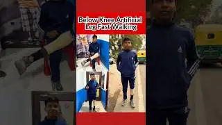 Below Knee Walking #artificialleg #prostheticlimb #artificiallimb #shortvideo #shortsfeed #foryou