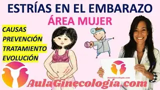 ESTRÍAS CUTÁNEAS EN EL EMBARAZO: CAUSAS, PREVENCIÓN, TRATAMIENTO, EVOLUCIÓN...