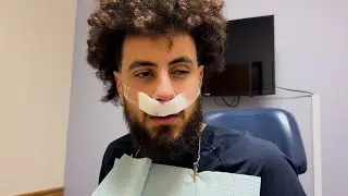 i broke my nose