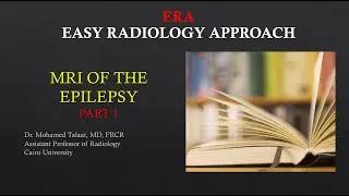 MRI Epilepsy Part 1