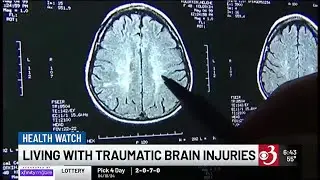 Health Watch: UVM researchers make strides in diagnosis, treatment of traumatic brain injuries