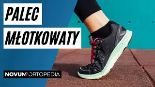 Skuteczne metody leczenia Palca Młotkowatego | Novum Ortopedia