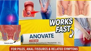 Anovate Cream Full Review | Piles & Fissure Me Kaise Kaam Karti Hai? Uses, Dose, Side Effects