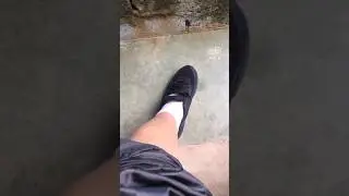 Tomei um tiro na perna 💣🔫 olha como ficou inchada 😪😰😢#shorts #youtubeshorts #engra&ccedil;ado #kkk