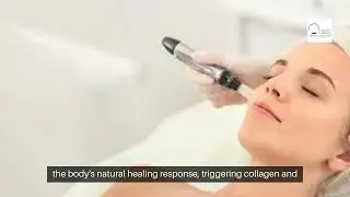 Unlock Clear Skin Secrets: Microneedling in Dallas, TX - A Game-Changer!