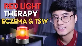 Healing Eczema & TSW with Red Light Therapy