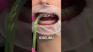 Da li ti nosis fixnu protezu? 😍
