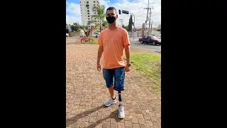 Joelho 3R80 da Ottobock: Tecnologia, Conforto e Sofistica&ccedil;&atilde;o