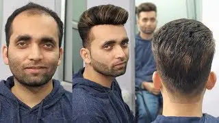 Stylish puffy highlighted hair patch system by anas sheikh, by anas sheikh call us 9650914665
