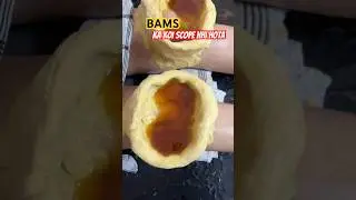 BAMS ka koi scope nhi hai ‼️#shorts #trending #ayurved #viral #mbbs #neet #bams #youtube