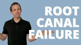 ASK DR. H &mdash; ROOT CANAL FAILURE