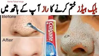 Face pack for glowing skin homemade | instant face whitening at home #blackheads #facemask #diy