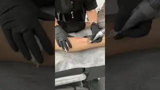 Leg camouflage