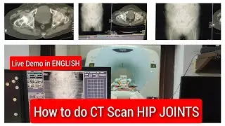 Hip Joints CT scan Protocol, Positioning & Planning | Live Demo in English.