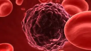 Circulating Tumour Cells (CTCs) - Dr. Joachim Fluhrer and Prof. Katharina Pachmann