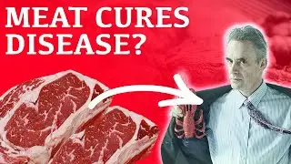 Are Vegetables Bad for You - Part 2 | The Plant Paradox