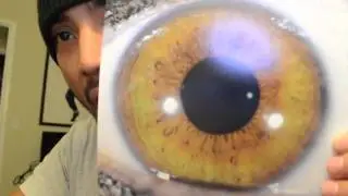 Iridology analysis. Eyes are the window to the soul