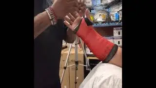 SHORT ARM CAST
