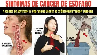 7 se&ntilde;ales tempranas del c&aacute;ncer de es&oacute;fago que pueden salvar tu vida hoy